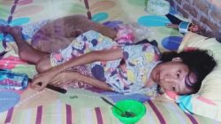 Sakit aneh [tak diketahui] yang mendera dan menggerogoti tubuh Maya Sari, 24 tahun dan anaknya, Rino Satrio, 8 tahun terlihat hanya tubuh terbalut kulit, pasrah membutuhkan uluran tangan dan donasi para dermawan untuk mengobati penyakitnya. Senin, 2 Januari 2022.
